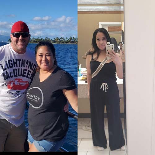 Before and After Images of Family Health Care Patients in Shoreline, WA