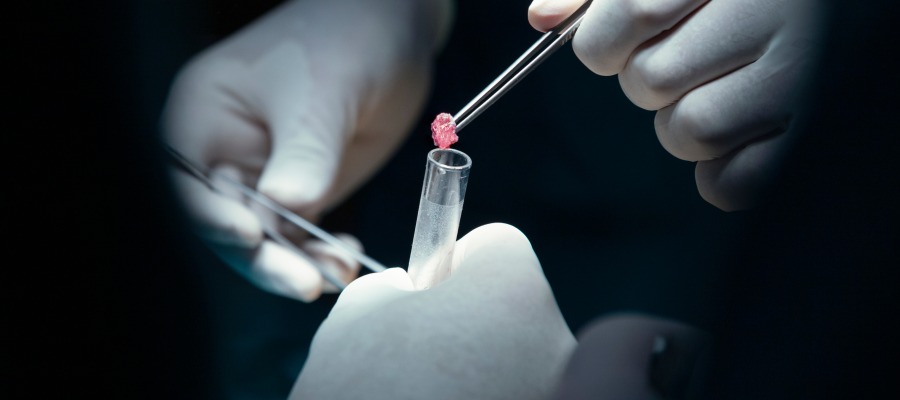 Minor Procedures Clinic in Shoreline WA