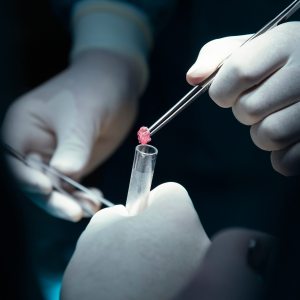 Minor Procedures in Shoreline WA