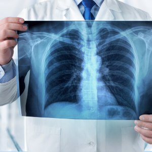 X Rays in Shoreline WA